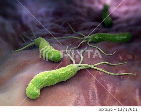 Helicobacter Pylori 13717611