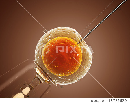 Artificial insemination Artificial insemination 13725629
