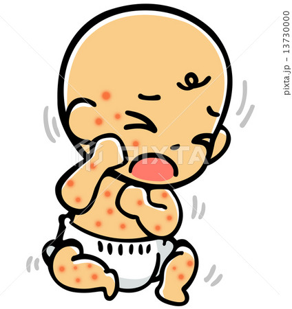 発疹赤ちゃん 13730000