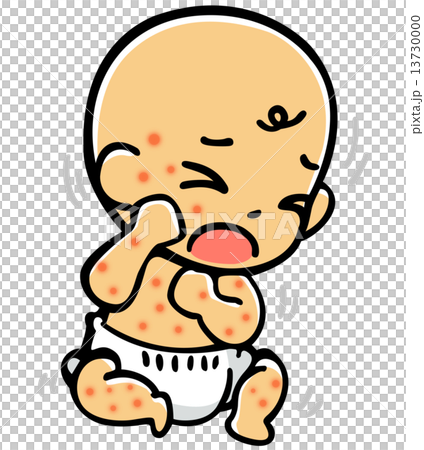 発疹赤ちゃん 13730000