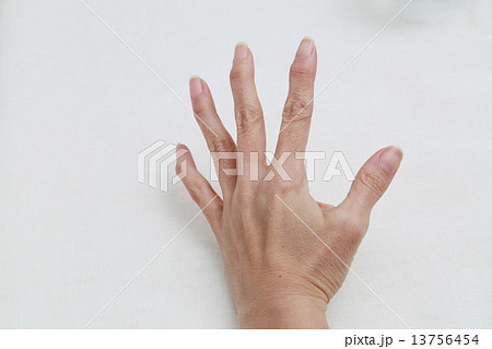 ヘバーデン結節 13756454