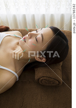 美容鍼 13786382