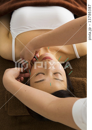 美容鍼 13786387