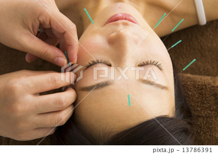 美容鍼 13786391