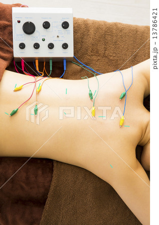 鍼治療 鍼治療 13786421