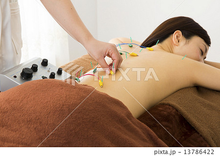 鍼治療の写真素材