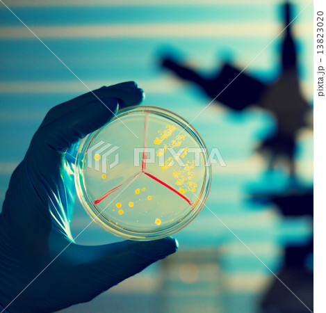 Petri dish in hand  and microscope  on laboratory background 13823020