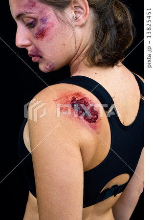 injured woman with open wound injured woman with open wound 13825451