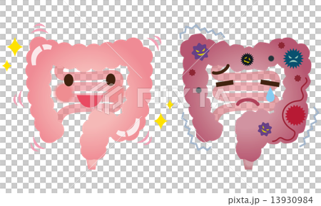 結腸癌是健康結腸病 結腸癌是健康結腸病 13930984