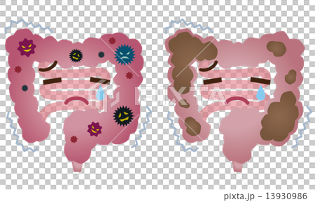 Colon of large intestine constipation sick Colon of large intestine constipation sick 13930986