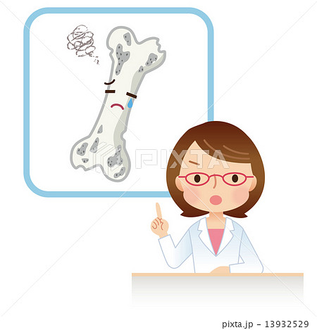 骨粗鬆症 説明する医師 骨粗鬆症 説明する医師 13932529