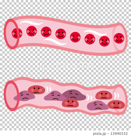 Blood flow section blood flow 13940332