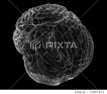 brain 13997421