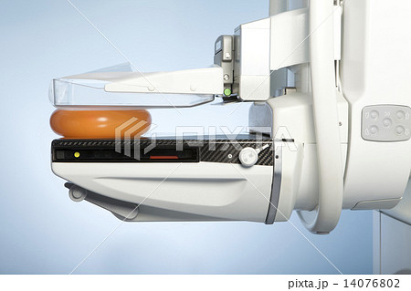 mammography machine mammography machine 14076802