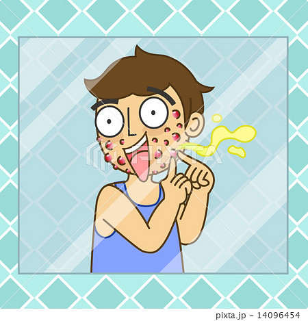 man squeezing pimple 14096454
