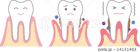 歯周病 14131403