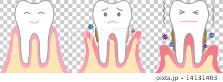 歯周病のイラスト素材