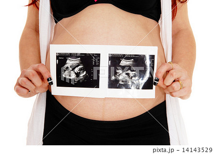 Pregnant women with ultrasound picture. Pregnant women with ultrasound picture. 14143529