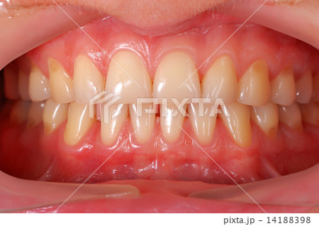 human teeth 14188398