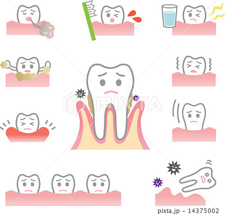 歯周病の症状のイラスト素材
