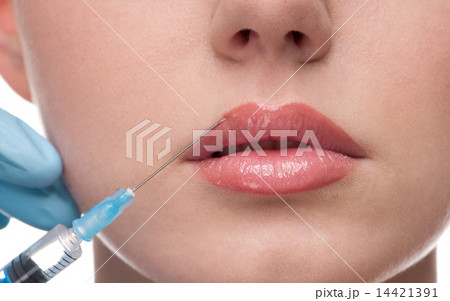 injection of botox to the face of beautiful woman 14421391