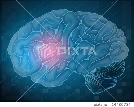 Brain with pain Brain with pain 14430754