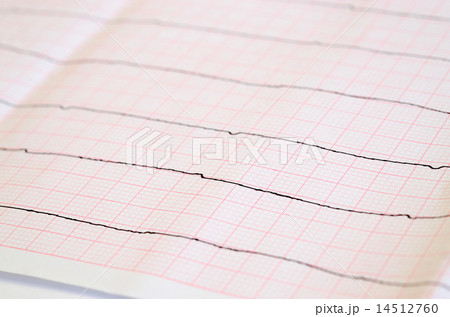 Tape ECG with ventricular asystole Tape ECG with ventricular asystole 14512760