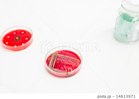 Petri dishes with growing bacteria 14613971