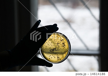Petri dish with growing bacteria 14614186