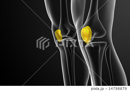 3d render medical illustration of the patella bone 14798879