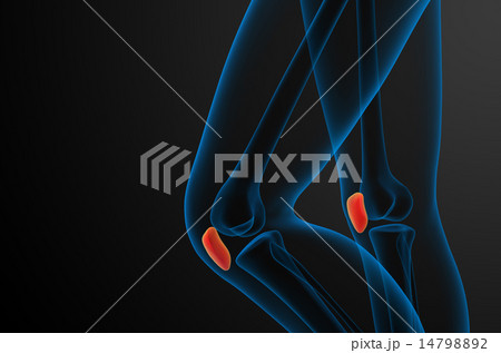 3d render medical illustration of the patella bone 14798892
