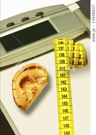acupuncture for weight loss acupuncture for weight loss 14848837
