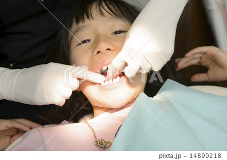 歯科医と子供（フロス） 14890218
