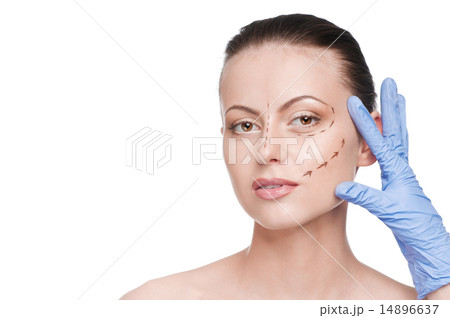 Correction lines on woman face, before surgery operetion Correction lines on woman face, before surgery operetion 14896637