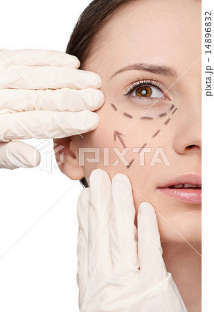 Correction lines on woman face, before surgery operetion 14896832
