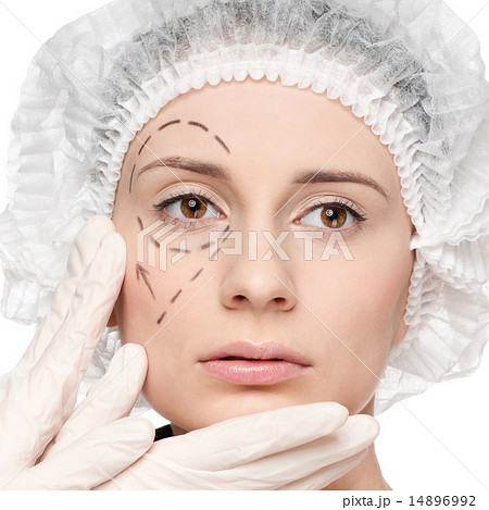 Correction lines on woman face, before surgery operetion 14896992
