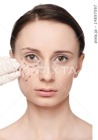 Correction lines on woman face, before surgery operetion 14897097