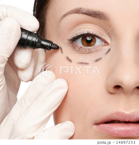 Correction lines on woman face, before surgery operetion 14897253
