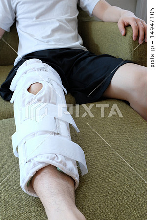 Meniscal Damage Injury After Surgery Stock Photo