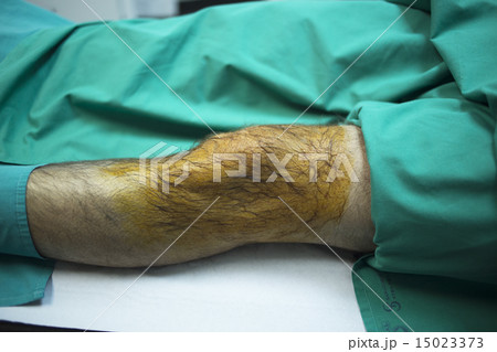 Patient in hospital clinic before injection of PRP 15023373