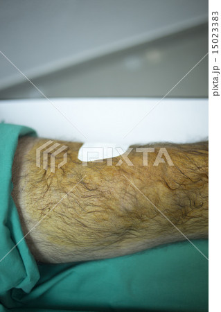 Patient in hospital clinic after injection of PRP 15023383