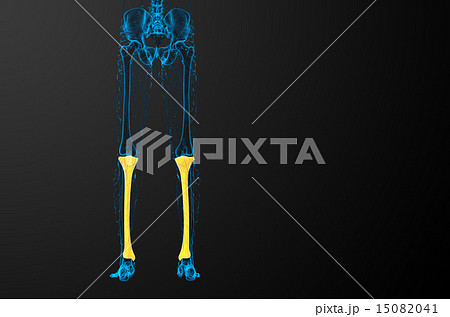 3d render medical illustration of the tibia bone 15082041