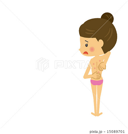 背中ニキビに悩む女性【二頭身・シリーズ】 15089701