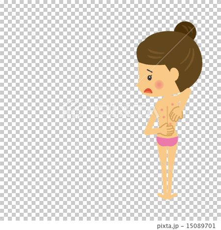 背中ニキビに悩む女性【二頭身・シリーズ】 15089701