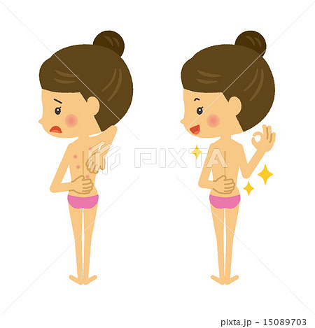 背中にブツブツができた女性 15089703