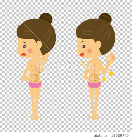 背中にブツブツができた女性 15089703