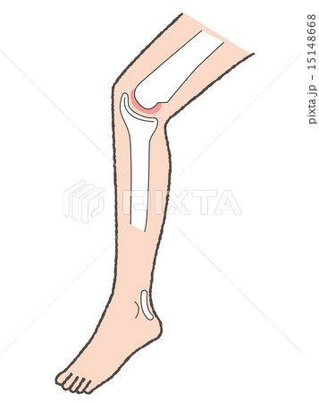 膝01 15148668