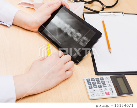 medic look on X-ray picture of vertebral colum medic look on X-ray picture of vertebral colum 15154071