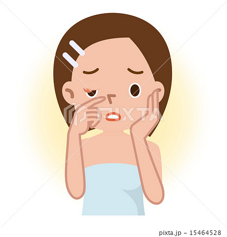 ものもらい 女性 15464528