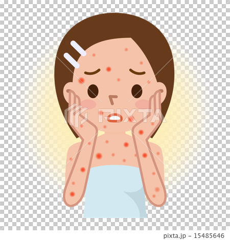 Rubella aids female 15485646